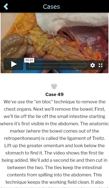 دانلود Autopsy 1.0 – برنامه کالبد شکافی بدن مخصوص اندروید